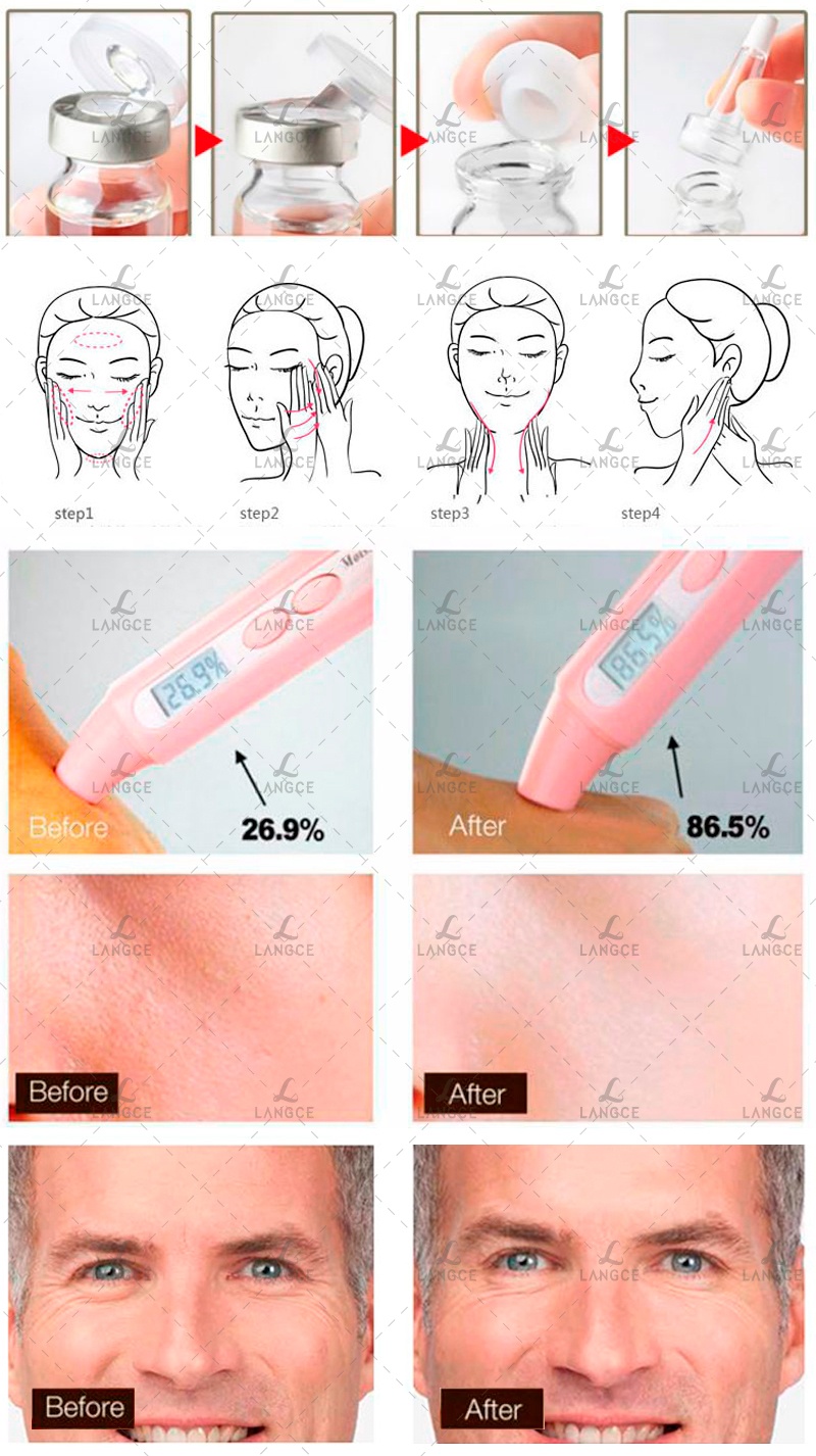 Serum Chữa Nám, Tàn Nhang, Đồi Mồi Collagen+ Đẹp Da 12ml LANGCE Total Beauty dành cho nam