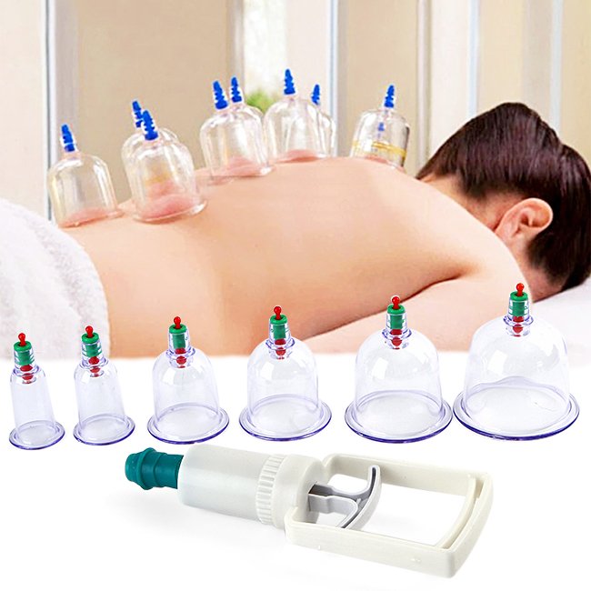Bộ 6 Ly Giác Hơi Không Dùng Lửa Ft001.