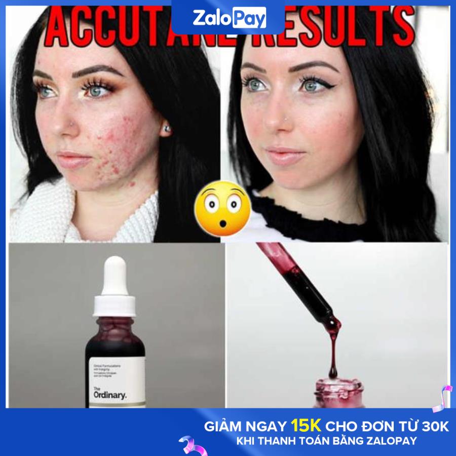 [Hcm]The Ordinary Aha 30% + Bha 2% Peeling Solution 30Ml Dung Dịch Lột Aha 30% + Bha 2% Nguyên Chất 30Ml Mặt Nạ Tẩy Tế Bào Chết 10 Phút Serum Dưỡng Da Xóa Sẹo Mụn Làm Trắng Da Chăm Sóc Da