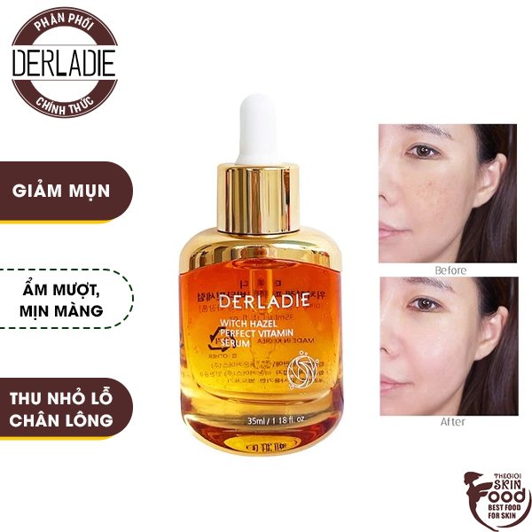 Tinh Chất Hỗ Trợ Giảm Mụn Chiết Xuất Cây Phỉ Derladie Witch Hazel Perfect Vitamin Serum 35Ml