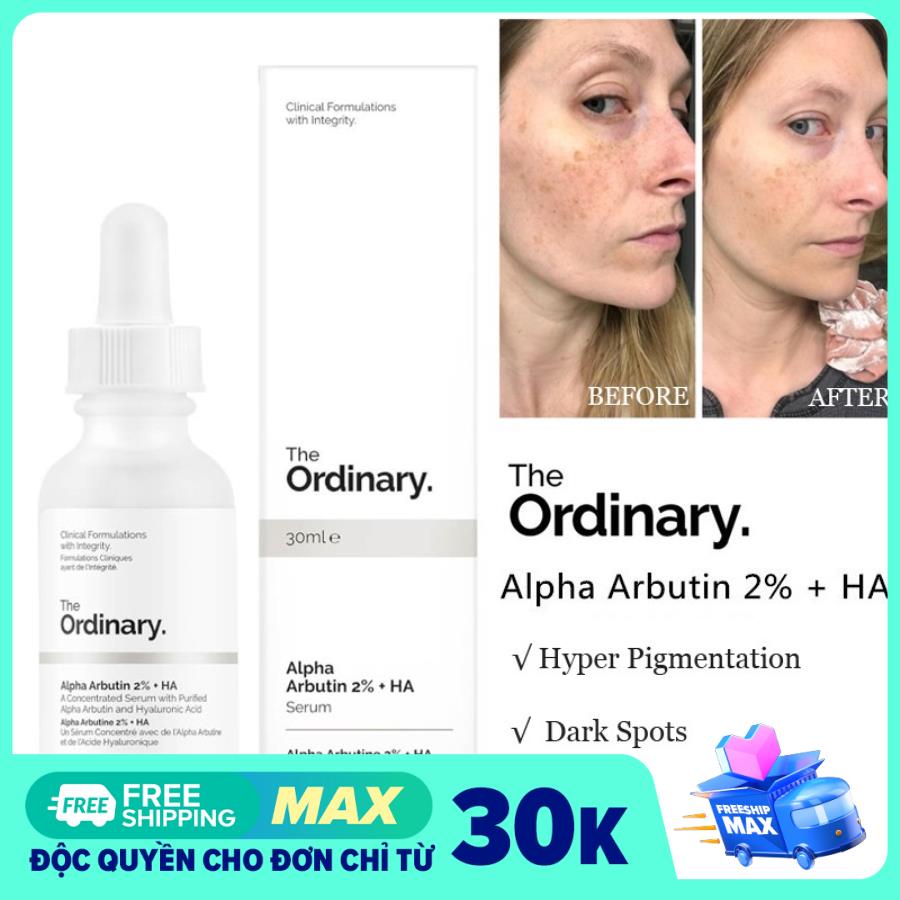 [HCM]The Ordinary Alpha Arbutin 2% + HA Serum Dưỡng Trắng Da Giảm Thâm Nâng Tone Da Tái Tạo Da Thích Hợp Da Mụn 30ml