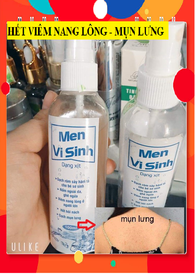DỨT ĐIỂM MỤN LƯNG KHÔNG TÁI PHÁT VỚI SẢN PHẨM THIÊN NHIÊN MIEN VI SINH TAVIDA CÔNG NGHỆ NHẬT BẢN dung kèm với Soap nghệ giúp da nhanh hết viêm