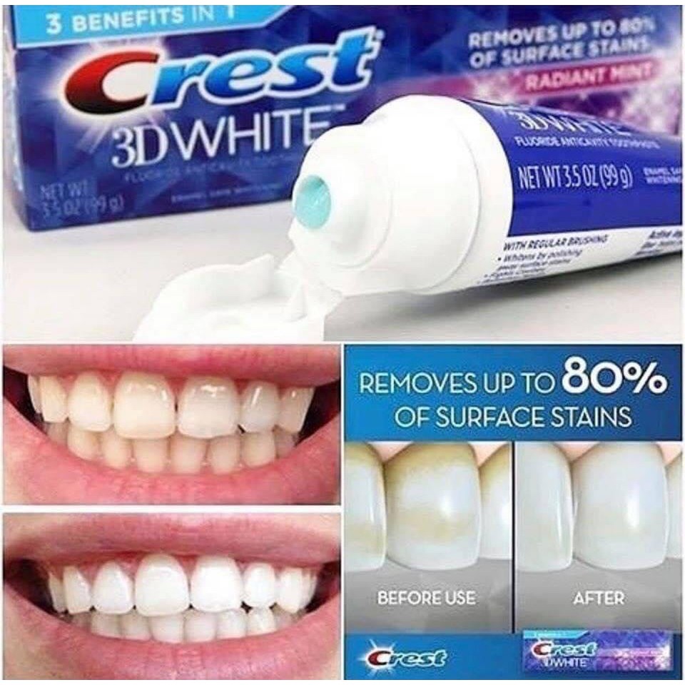 [ Mẫu Mới Của 170Gr ] Kem Đánh Trắng Răng Crest 3D White