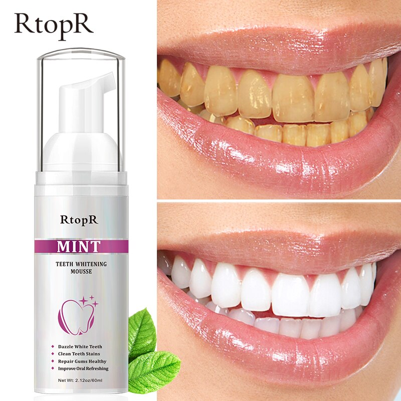 [HCM]RtopR Bọt Tẩy Trắng Răng Làm Sạch Răng Khử Mùi Hôi Miệng Mousse Teeth Whitening Clean Teeth 60ml