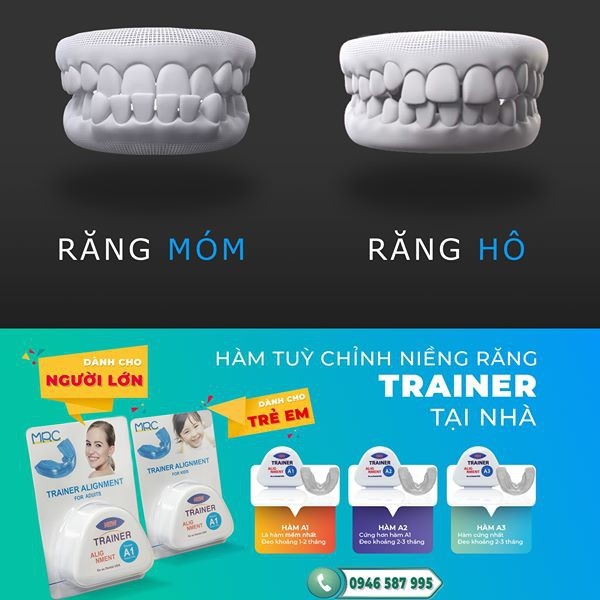 [HCM][Hàm Lẻ A1]Niềng Răng Chỉnh Nha Tại nhà  dành cho người lớnNiềng Răng bị hô răng thưa răng mọc lệch tại nhà