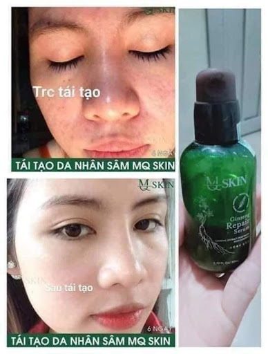 Serum Nhân Sâm Tái Tạo Da Qm Skin Chính Hãng