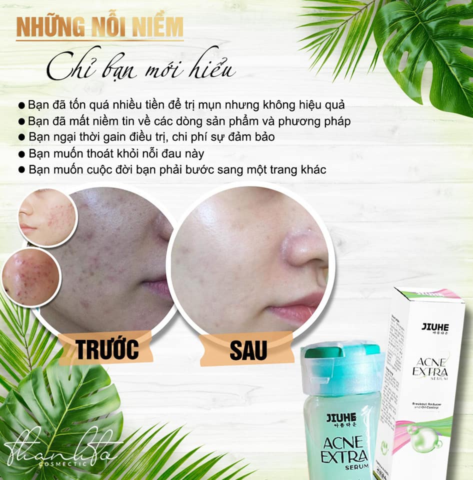 Serum Khử Mụn Acne Extra Jiuhe Chuyên Khử Mụn Viêm  Mụn Đầu Đen  Mờ Thâm