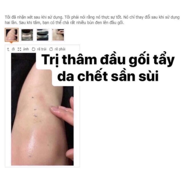 Kem Trị Thâm Nách - Đầu Gối Đặc Trị Hiệu Quả Ức Chế Melanin Làm Sáng Da Hydrat Khóa Trong Nước Sửa Chữa Và Thúc Đẩy Lưu Thông Máu Trên Da