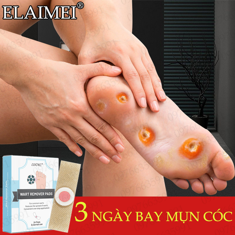 3 Ngày Cho Kết Quả Elaimei Miếng Dán Mụn Cóc 24 Miếng/Hộp Không Đau Đớn Đi Sâu Vào Da Trị Tận Gốc Ngăn Ngừa Tái Phát (Miếng Dán Mụn Cơm Mụn Cóc Miếng Dán Mụn Cóc)