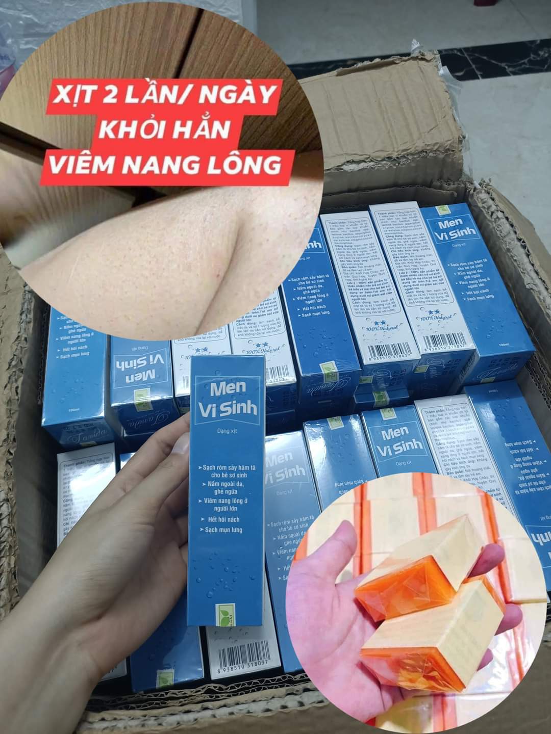 Combo Diệt Tận Gốc Viêm Nang Lông Mụn Lưng Bằng Men Vi Sinh Tavida 100Ml Và Soap Nghệ