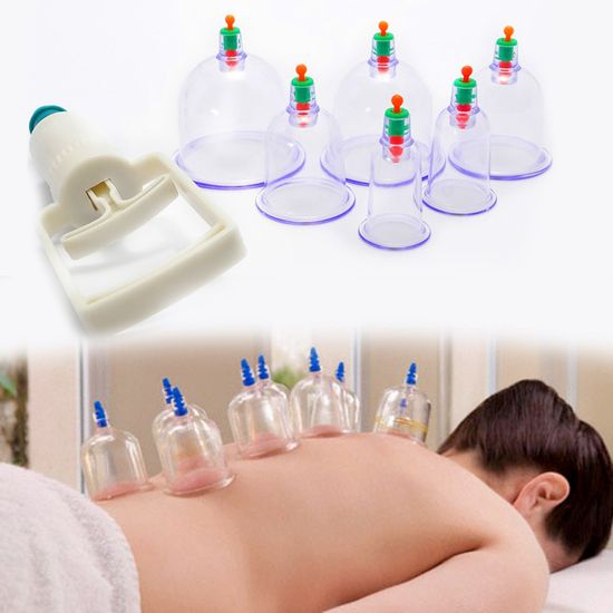 Giao siêu tốc 24h - Bộ giác hơi 12 ống hút chân không hỗ trợ đau nhức xương khớp mệt mỏi đau lưng đau cơ giảm stress