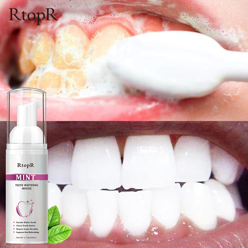 [HCM]RtopR Bọt Tẩy Trắng Răng Làm Sạch Răng Khử Mùi Hôi Miệng Mousse Teeth Whitening Clean Teeth 60ml