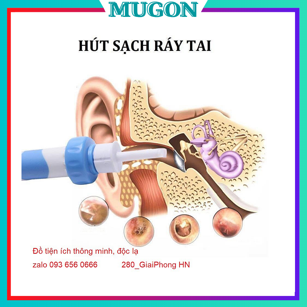 Dụng Cụ Lấy Ráy Tai Thần Thánh I - Ears