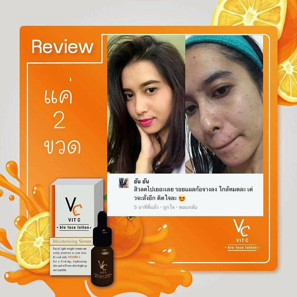 Serum Vitc Serum Cung Cấp Vitamin C Dưỡng Ẩm Kiềm Dầu Trị Thâm Mun Phục Hồi Da Hư Tổn Sau 2 Tháng Sử Dụng