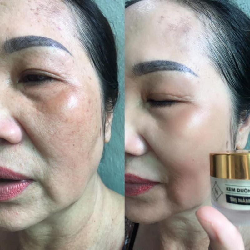 [Hcm]Kem Dưỡng Da - Tri Nám Mây Cream