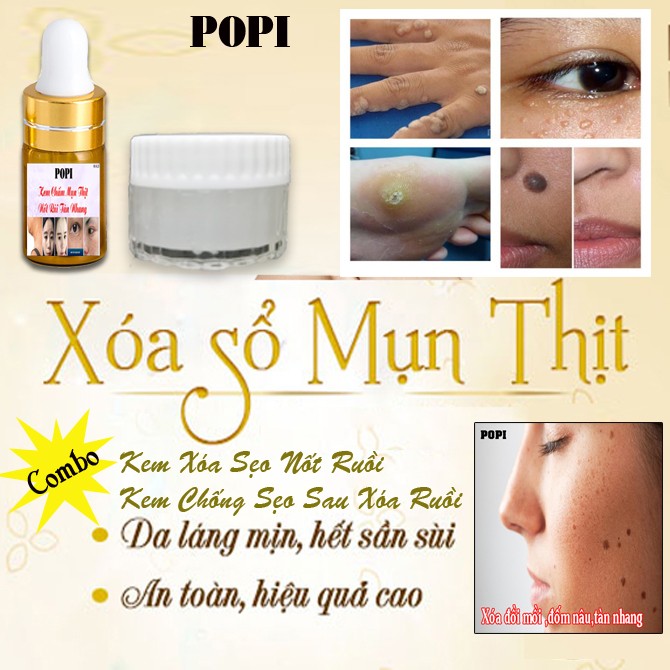 Set Kem Xóa Ruồi + Kem Chống Sẹo Popi