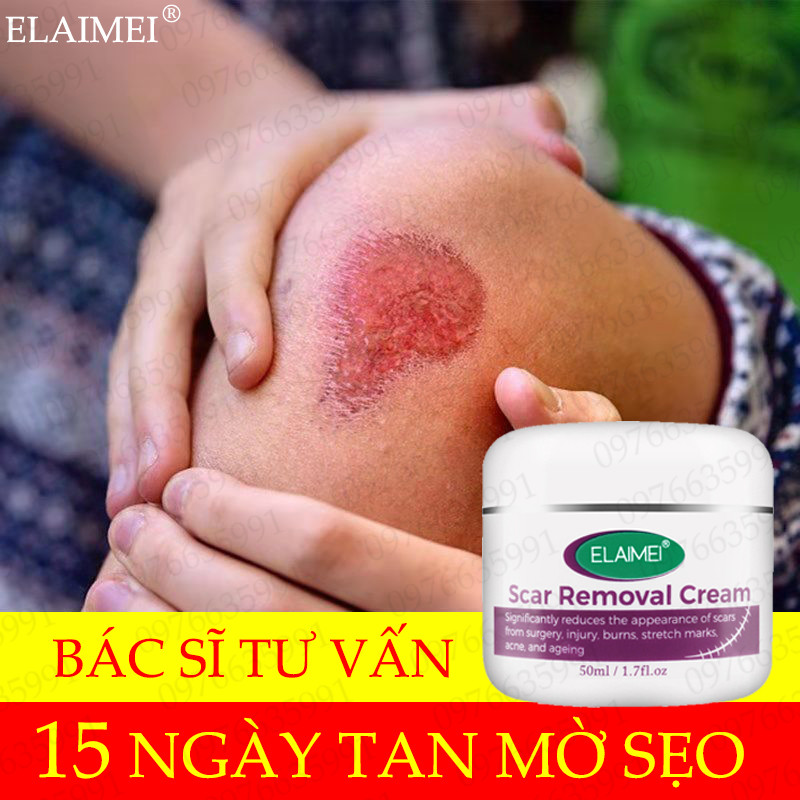 ❤Bác Sĩ Tư Vấ❤Elaimei Kem Mờ Sẹo 50G Nuôi Dưỡng Sâu Cải Thiện Sẹo.thích Hợp Cho Sẹo Mụn Bỏng Và Bỏng Nước Sẹo Phẫu Thuật Vv (Gel Trị Sẹo Kem Tẩy Xóa Sẹo Kem Trị Sẹo Lồi Kem Làm Mờ Sẹo)