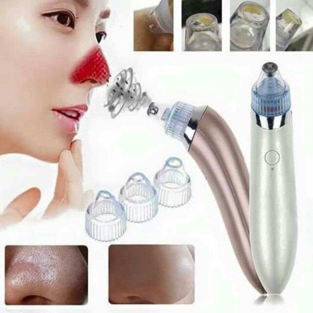 Máy Hút Mụn máy hút mụn cao cấp mã 001. Thiết bị hút mụn thần kỳ khiến các chị em phát sốt  giá cực SỐC! (F-HCM)