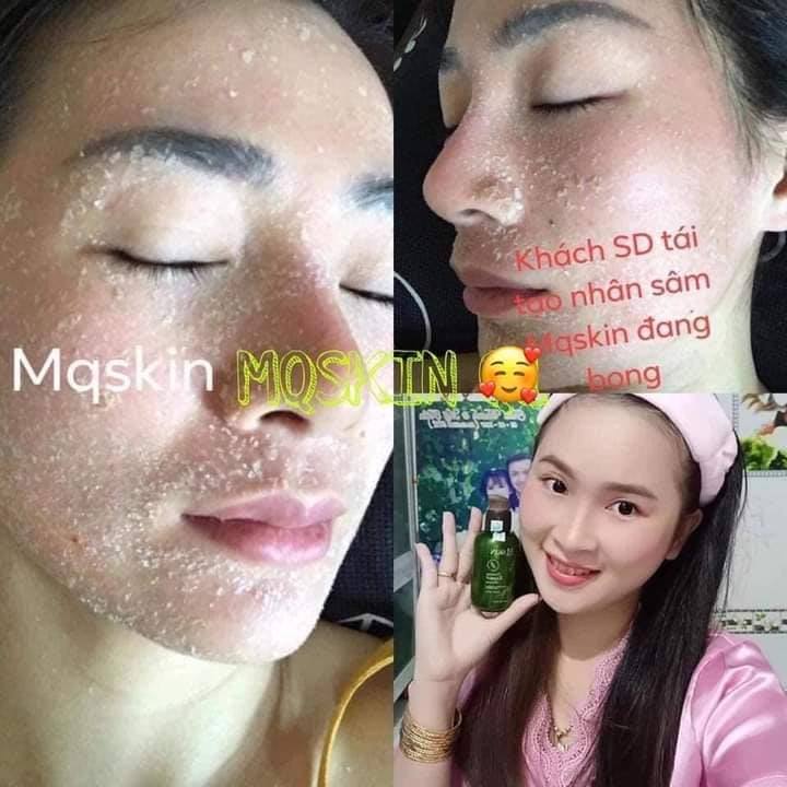 Serum Tinh Chất Nhân SâmTái Tạo Da Cao Cấp MQSKIN 80ML ( Mẫu Mới )