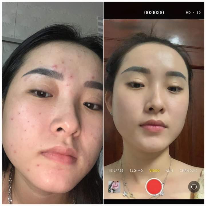 sữa rửa mặt đông y gia truyền