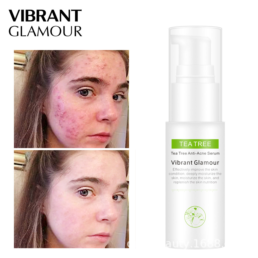 Toner Trà Xanh Chống Mụn Sẹo Thu Nhỏ Lỗ Chân Lông Kiểm Soát Dầu Dưỡng Trắng Da 30Ml Vibrant Glamour