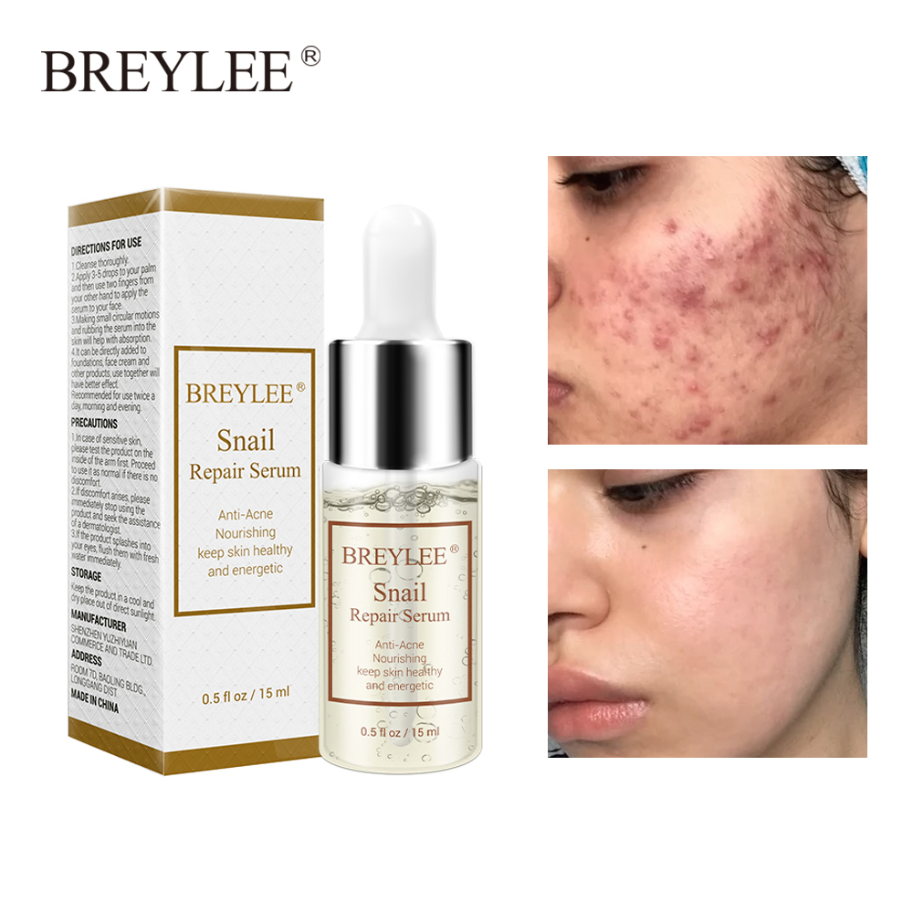 [Hcm]Breylee Serum Dưỡng Trắng Tái Tạo Da Loại Bỏ Mụn Trứng Cá Phục Hồi Da Căng Mịn Repair Snail Compact Moisturizing Anti - Aging Facial Care 15Ml