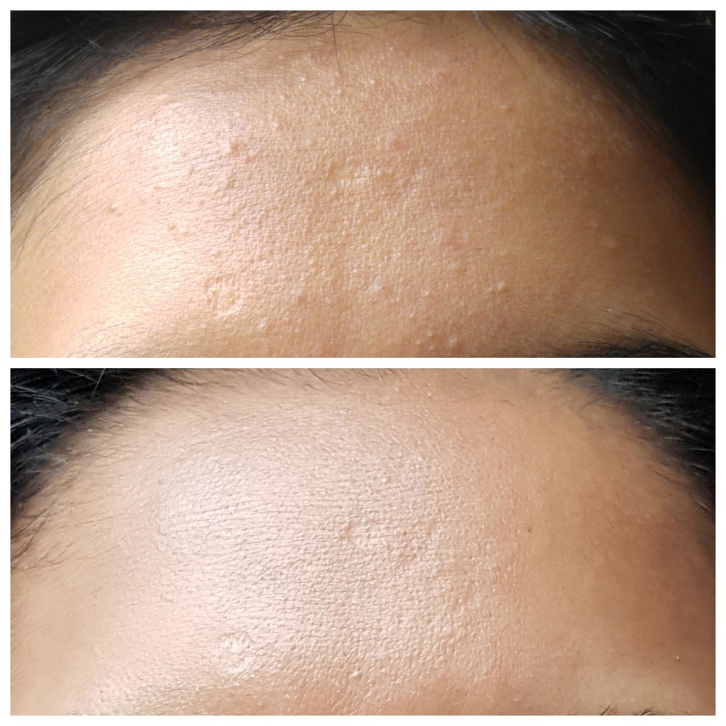 [Hcm]Dung Dịch Tẩy Tế Bào Chết Hoá Học Cosrx Aha 7 Whitehead Power Liquid Exfoliator Sản Phẩm Tốt Với Chất Lượng Độ Bền Cao Và Được Cam Kết Sản Phẩm Y Như Hình