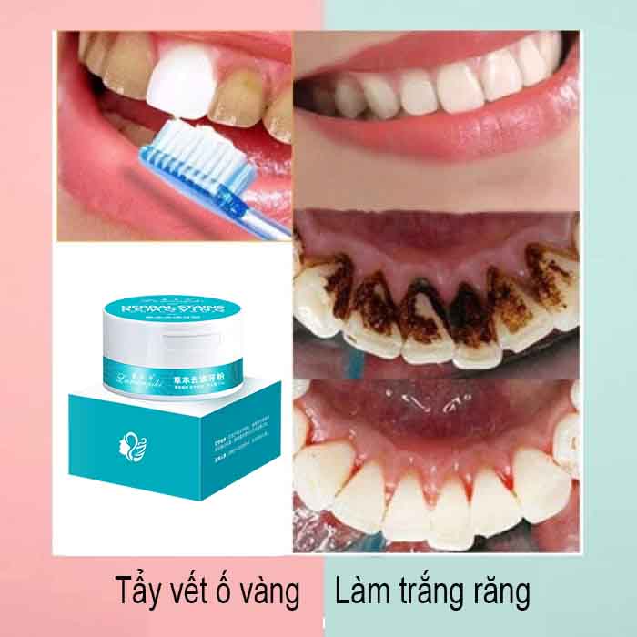 Bột đánh răng baking soda làm sáng răng. Bột tẩy trắng răng - chất làm trắng răng bảo vệ men răng – chăm sóc răng miệng – kem đánh răng cao cấp 50g – bột khử mùi hôi răng miệng hiệu quả cấp tốc – hiệu quả cấp tốc sau