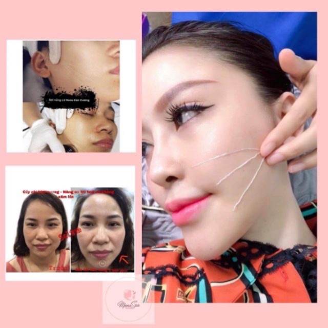 Chỉ Kim Cương SELINA Căng Da Xoá Nhăn Hiệu Quả