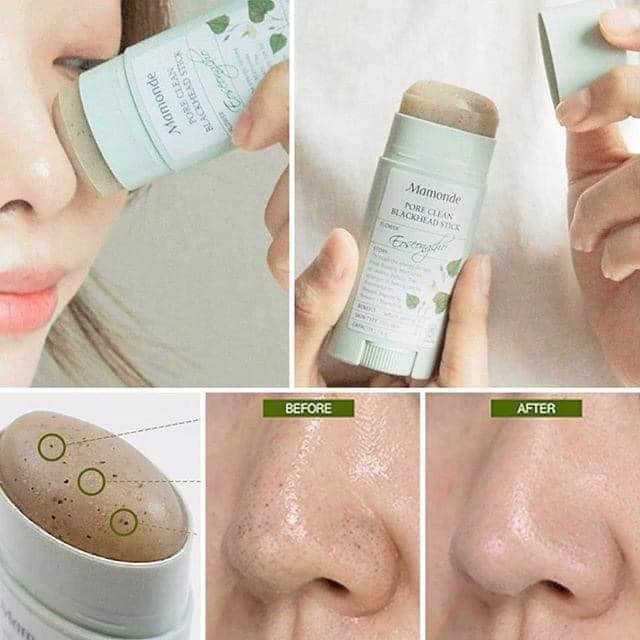 Thanh Lăn Trị Mụn Đầu Đen Mamonde – Hàn Quốc