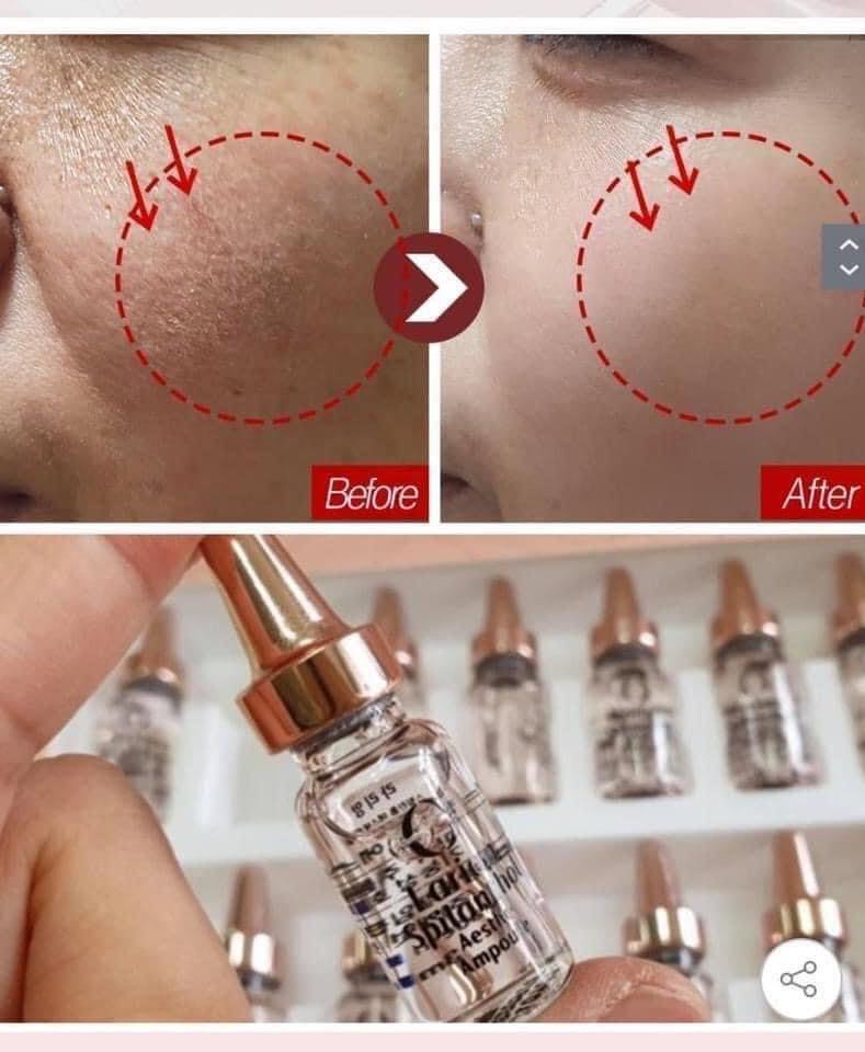 Căng bóng như siêu sao tinh chất LARIAN SPILANTHOL AESTHE AMPOULE.