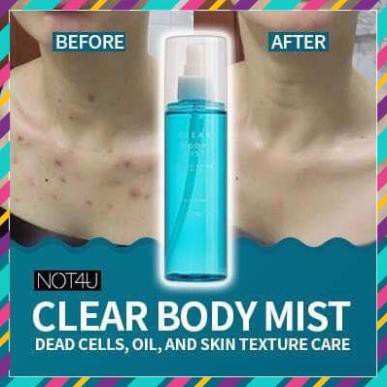 Xịt Mụn Lưng Toàn Thân Not4U Clear Body Mist 200Ml Cam Kết Hàng Đúng Mô Tả Chất Lượng Đảm Bảo An Toàn Đến Sức Khỏe Người Sử Dụng