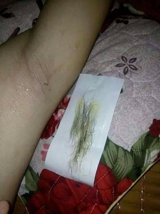 was lông triệt lông tay chân nách dâu ria.... vĩnh viễn (tặng thêm giấy và que gạt )