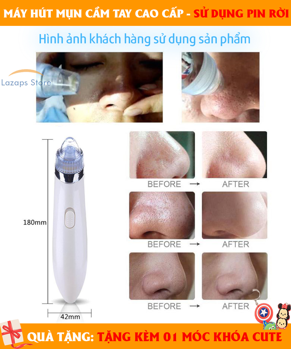 Máy Hút Mụn Beauty Skin Cách Để Trị Mụn Đầu Đen Và Mụn Cám Dễ Dàng Máy Hút Mụn Cầm Tay - Sở Hữu 3 Đầu Hút Hiệu Quả Hút Sạch Mụn Và Bụi Bẩn - Giúp Mát Xa Làm Căng Da Mặt Mờ Nếp Nhăn Dễ Dàng!