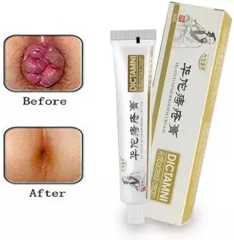 [HCM]Kem Bôi Trĩ 100% Original Hemorrhoids Ointment Cream Chinese Medicine HuaTuo Shrink Swollen Hemorrhoid Tissue Reduce Heat and Inflammation Relieve Hemorrhoid Pain Clear Away Toxic Materials Remove Decayed Tissues