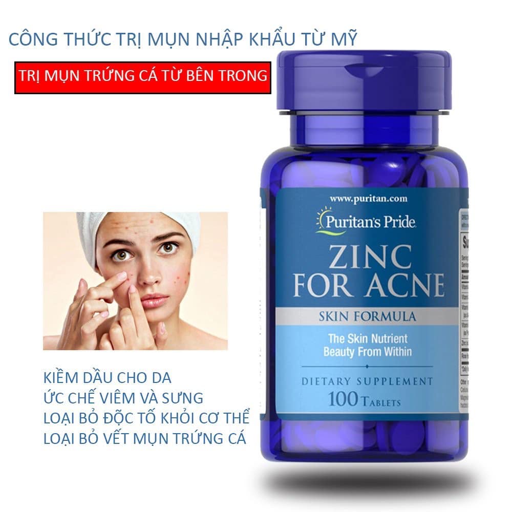 [HCM]TPCN Zinc for Acne – Viên Uống Kẽm Trị Mụn