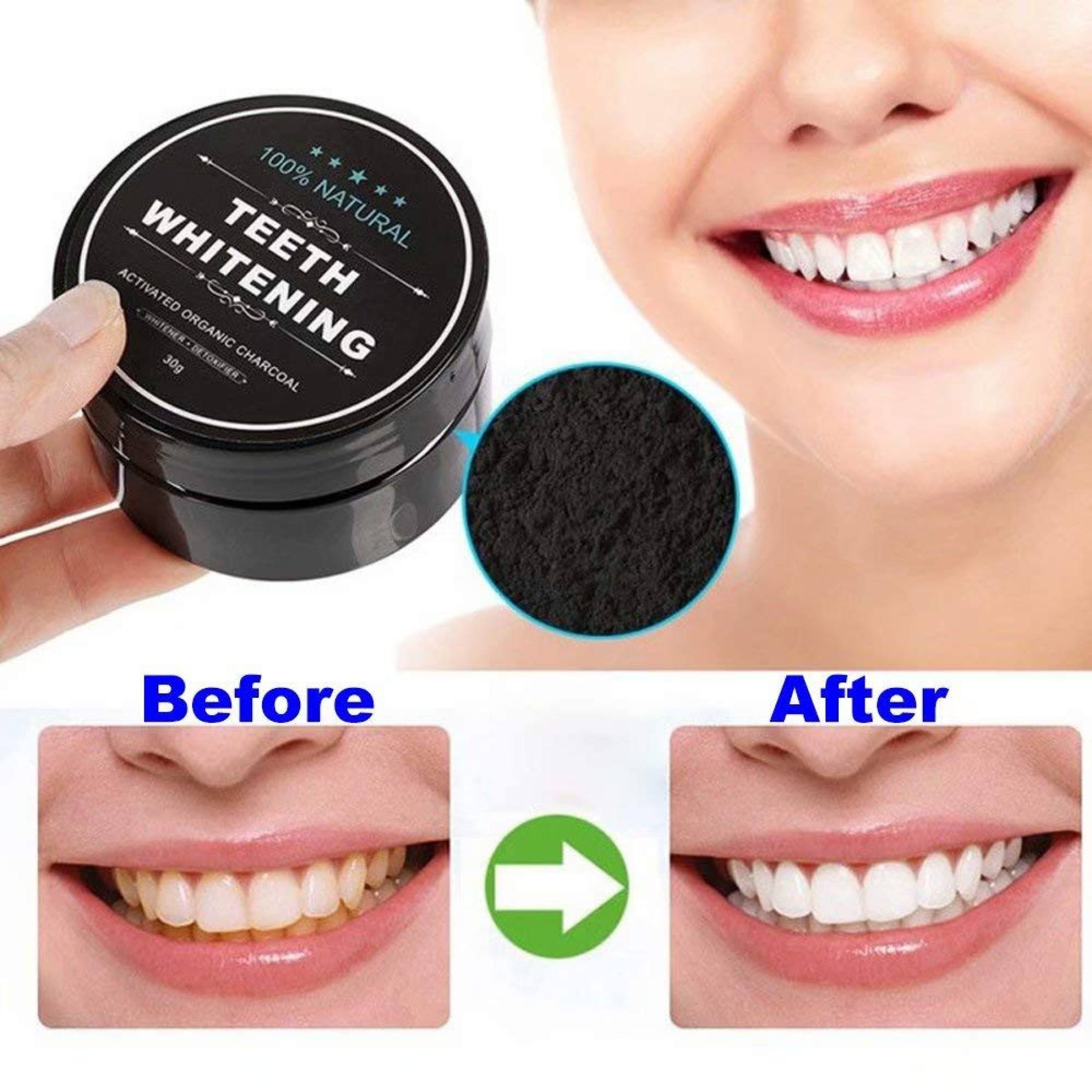 [Hcm]Than Tre Tẩy Trắng Răng Teeth Whitening - Huynhi Shop