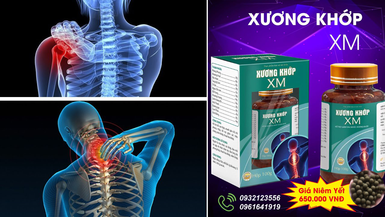 Xương Khớp Xm | Đông Y Xứ Mường | Hỗ Trợ Điều Trị Thoái Hóa Khớp Viêm Đa Khớp Đau Dây Thần Kinh Toại| Tặng Kèm Cao Xoa Bóp Xm