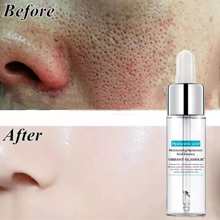 Hyaluronic Acid Essence For Dark Spots - Shrink Pores To Brighten Skin Vibrant Glamour