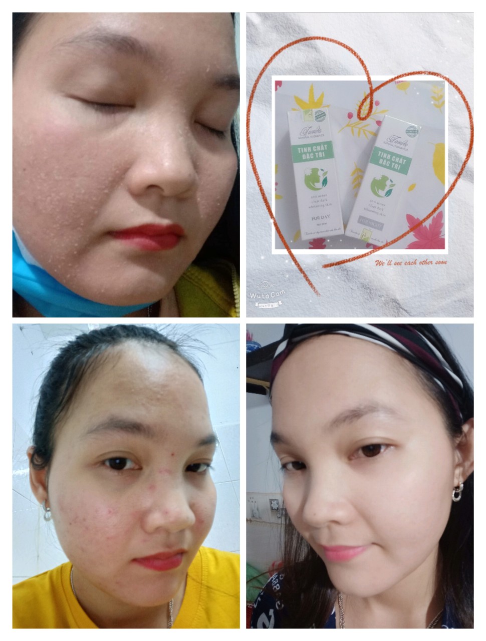 Serum Mụn Tavida Tái Tạo Da For Day - Nên Dùng Đủ Bộ Ngày Đêm Da Nhanh Đẹp