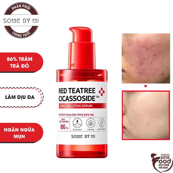 Tinh Chất Cho Da Siêu Nhạy Cảm Chiết Xuất Tràm Trà Đỏ Some By Mi Red Teatree Cicassoside Final Solution Serum 50Ml