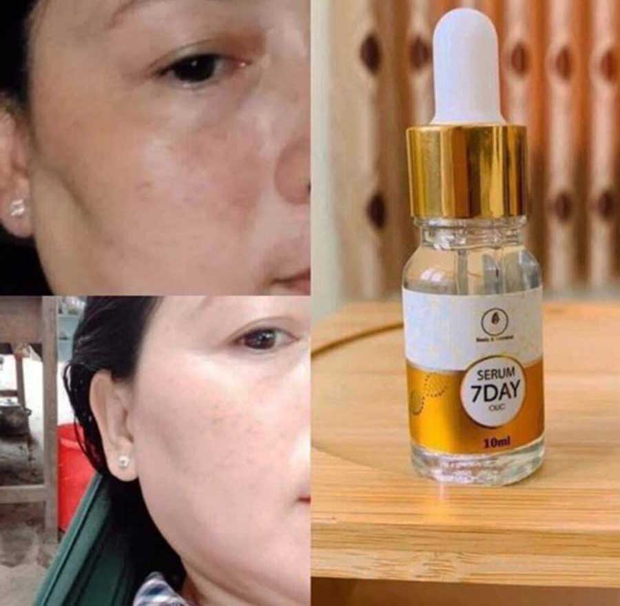 Serum 7 Day Olic Dưỡng Da Trắng Hồng Se Khít Lỗ Chân Lông