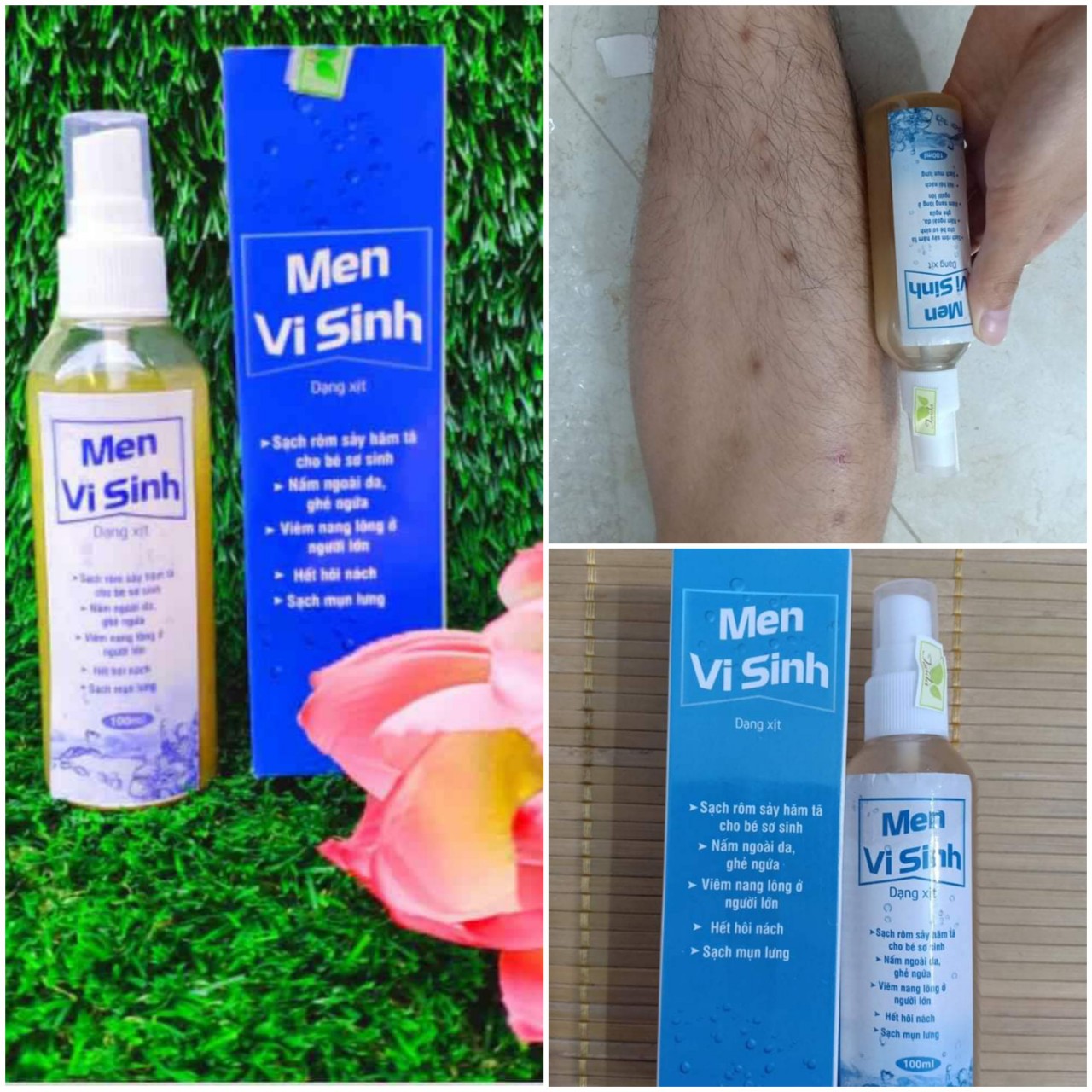 Combo 3 Chai Men Vi Sinh Tavida Làm Sạch Viêm Da Mụn Nấm Ngứa Combo Phù Hợp Cho Những Ai Mụn Nặng Giá Ưu Đãi Và Đỡ Phí Ship
