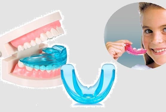 [ HÀNG CHUẨN LOẠI 1] DỤNG CỤ NIỀNG RĂNG TẠI NHÀ CAO CẤP