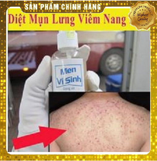 Serum Trái Cây - Xịt Men Vi Sinh Tavida 100Ml Dứt Điểm Sạch Mụn Lưng Viêm Nang Lông Mẩn Ngứa Hăm Tả Ở Người Lớn Và Trẻ Nhỏ