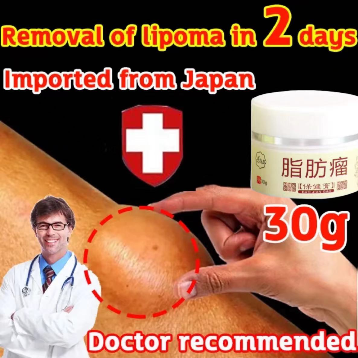 [HCM]30g Kem mềm u mỡ Lipoma Cream Subcutaneous Lump Removing Cream Lipoma Removal Cream Original Sk