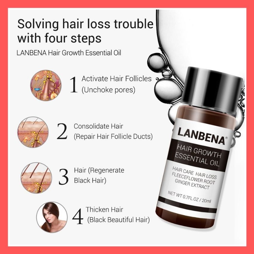 [HCM]Tinh Dầu Tăng Trưởng Kích Thích Mọc Tóc giúp Tóc Chắc Khỏe Tăng Bảo Vệ Da Đầu Giúp Tóc Không Bị Gãy Rụng Hói Đầu Dung Tích 20Ml