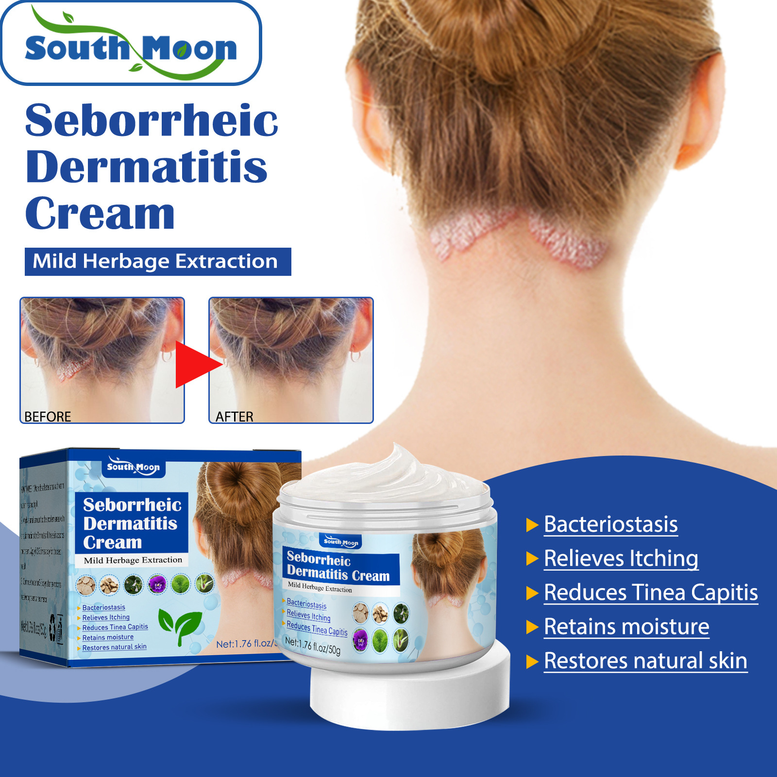 Herbal Seborrheic Dermatitis Cream for Dermatitis Eczema Psoriasis Skin Ringworm Peeling Anti Itchin