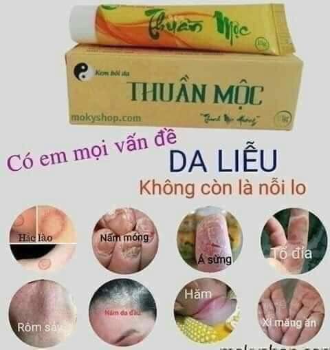 Kem Bôi Da Thuần Mộc #110K Giúp Loại Bỏ: ✔️Hắc Lào ✔️Các Loại Viêm Da Cơ Địa Chàm Hăm... ✔️Nấm Móng Chân Tay Nấm Đầu Nấm Kẽ Nấm Âm Đạo... ✔️Viêm Lỗ Chân Lông ✔️Nước Ăn Chân Tay ✔️Mẩn Ngứa ✔️Côn Trùng Đốt ✔️Lột Da Chân Tay