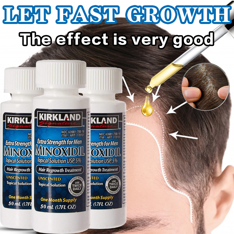 Minoxidil 5% Thuốc bổ tóc Vitamin mọc tóc Điều trị mọc tóc